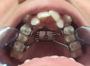 WhatsApp Image 2021-01-26 at 12.00.23